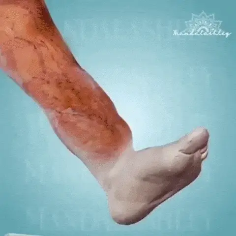 Kinoki gif